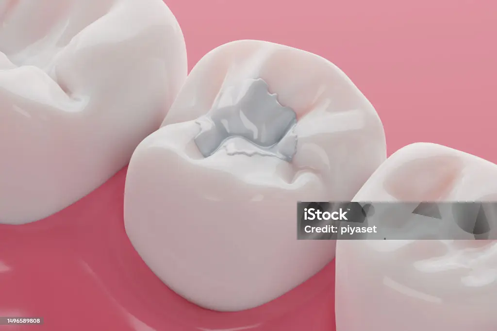 Fillings